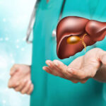 What You Need to Know About Pancreatic Cancer