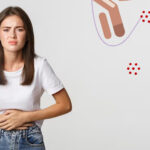 Vaginal Candidiasis/Yeast infection